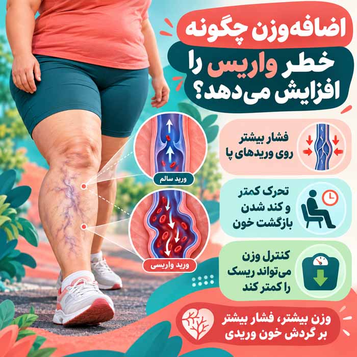 دلیل ایجاد واریس چیست؟ علتهای اصلی، عوامل خطر و نشانههایی که نباید نادیده گرفت اضافهوزن چگونه خطر واریس را افزایش میدهد؟