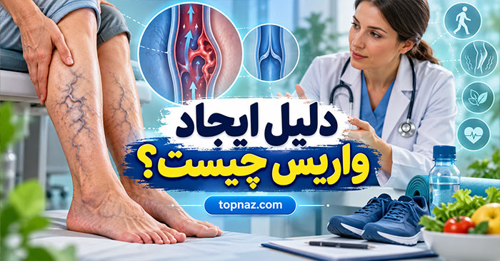 دلیل ایجاد واریس چیست؟ علتهای اصلی، عوامل خطر و نشانههایی که نباید نادیده گرفت دلیل ایجاد واریس چیست؟ علتهای اصلی، عوامل خطر و نشانههایی که نباید نادیده گرفت