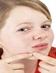 پیشگیری و درمان جوش های سر سفید