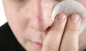 به همین راحتی جوش صورت را نابود کنید از بین بردن جوش صورت