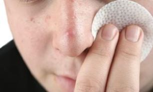 به همین راحتی جوش صورت را نابود کنید