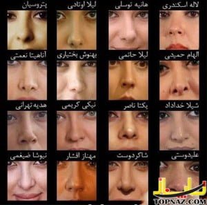 کدام بازیگران ایرانی دماغ عملی هستند؟ +عکس جراحی بینی بازیگران
