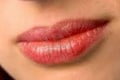 چرا لب خشک و پوسته پوسته می شود؟ علل خشکی و پوسته پوسته شدن لب ها چیست؟