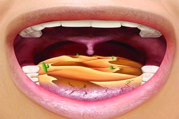 با مشکل دهان خشک چه کنیم؟