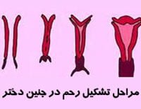 راه تشخیص دو رحم بودن زنان و درمانش