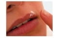 دلیل تبخال زدن چیست؟ تب خال