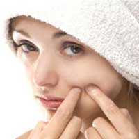 درمان جوش صورت در دوران بلوغ