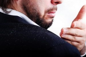 چگونه شوره سر را از بین ببریم؟