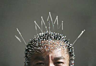 درمان سیاهی دور چشم با طب سوزنی درمان سیاهی دور چشم با طب سوزنی