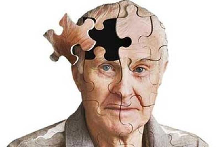 10 نشانه اولیه بیماری آلزایمر و علائم هشدار دهنده شروع این بیماری 10 نشانه اولیه بیماری آلزایمر و علائم هشدار دهنده شروع این بیماری