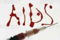 نحوه تشخصی و راه های انتقال ایدز Aids نحوه تشخصی و راه های انتقال ایدز Aids