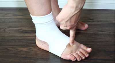 رفع ورم پا در دوران بارداری