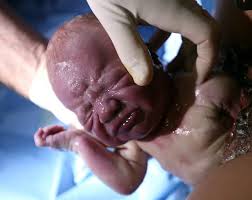 لحظه زایمان دقیقا چه زمانی آغاز می شود