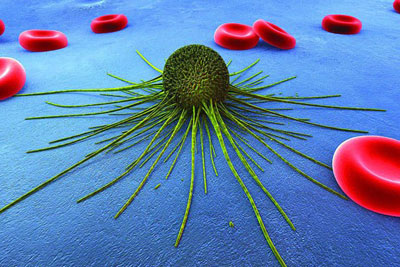 رژیم غذایی بیماران سرطانی