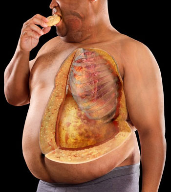 تصلب شرایین یا گرفتگی عروق چیست