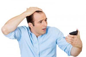 مشکل ریزش موی مردان و حل ریزش مو