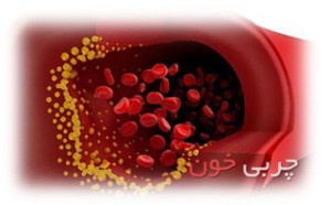 پیشگیری از چربی خون و کنترل چربی خون