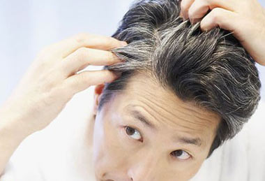 دلیل سفید شدن موها در سنین بالا چیست؟