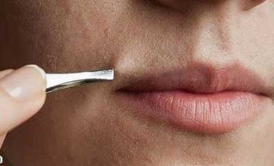 موهای زیر پوستی پیشگیری و درمان رشد موهای زیر پوستی