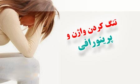 تنگ کردن واژن به روش پرینورافی چگونه است؟