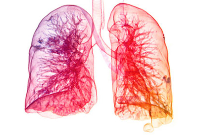 عادت هایی بد که باعث آسیب دیدن ریه ها می شوند