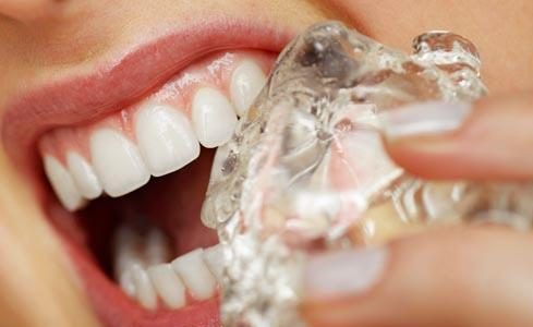 عادت های بدی که منجر به پوسیدگی دندان ها می شوند