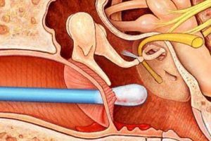 کمک های اولیه هنگام پاره شدن پرده گوش