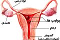پولیپ رحم در مان پولیپ رحم در خانم ها و اطلاعاتی از پولیپ رحم پولیپ رحم در مان پولیپ رحم در خانم ها و اطلاعاتی از پولیپ رحم