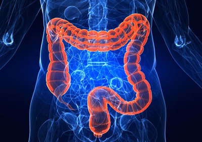 دلیل سرطان روزده بزرگ چیست؟