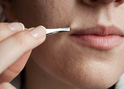 روش به تاخیر انداختن رشد مجدد موهای زائد روش به تاخیر انداختن رشد مجدد موهای زائد