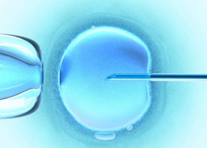 با آی وی اف ناباروری را درمان کنید IVF با آی وی اف ناباروری را درمان کنید IVF