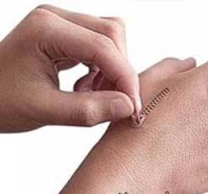 روشی ارزان و راحت برای از بین بردن جای زخم