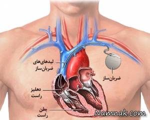 اطلاعاتی در مورد باتری قلب یا پیس میکر "ضربان ساز قلب" اطلاعاتی در مورد باتری قلب یا پیس میکر “ضربان ساز قلب”