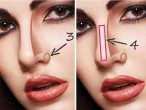 روش های کانتور کردن انواع مدل بینی
