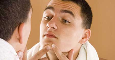 خوردن این غذاهای سالم باعث ایجاد جوش می شود!