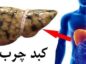سیگار برای افرادی که کبد چرب دارند بسیار مضر است