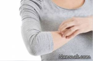 دلیل خارش پوست و کهیر زدن پوست چیست؟ دلیل خارش پوست و کهیر زدن پوست چیست؟