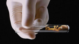 روش آی وی اف برای بچه دار شدن و تمام دردسرها و هزینه های IVF