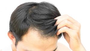 فیناستراید چیست و برای درمان چه بیماری هایی مورد استفاده قرار میگیرد؟ فیناستراید چیست و برای درمان چه بیماری هایی مورد استفاده قرار میگیرد؟