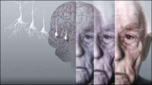 مشکلات یک بیمار آلزایمری و نحوه برخورد با کسی که آلزایمر دارد مشکلات یک بیمار آلزایمری و نحوه برخورد با کسی که آلزایمر دارد