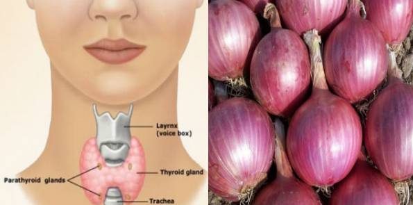 درمان تیروئید با پیاز قرمز + روش استفاده