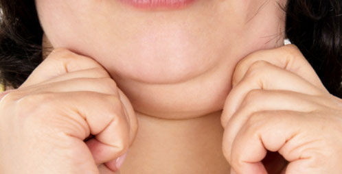 5 تمرین برای رفع غبغب