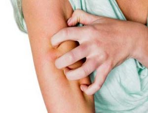 دلیل خارش زیر بغل چیست و چگونه این خارش را از بین ببریم؟