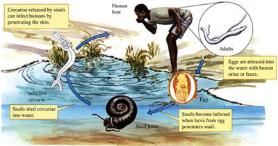 بیماری شیستوزومیازیس یا تب حلزون و درمان آن