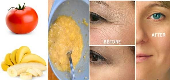 فقط در 3 روز چین و چروک صورت را از بین ببرید