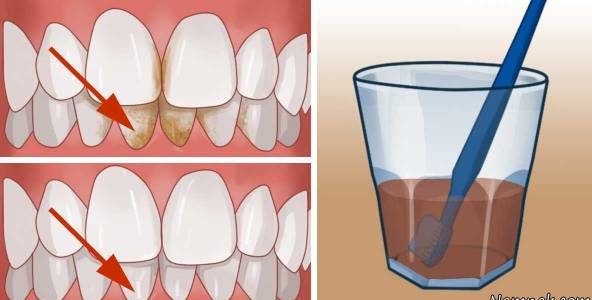 “سفید کردن دندان” با روش های مختلف خانگی و بدون ضرر
