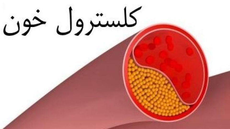 8 خوراکی که کلسترول بد خون را پایین می آورند
