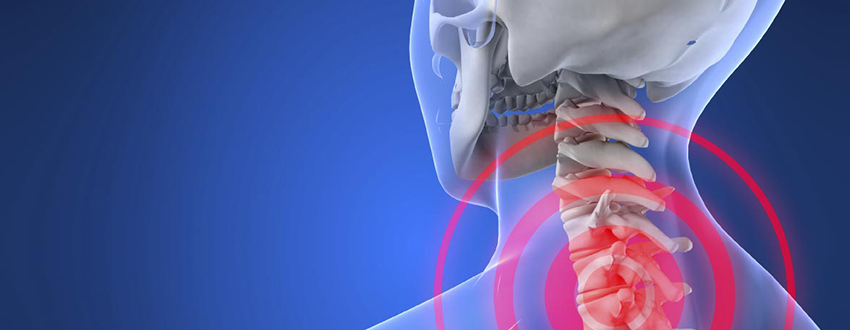 آرتروز گردن