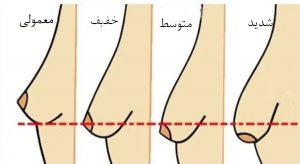 نحوه ماساژ دادن سینه برای سفت شدن و خوش فرم شدن آن