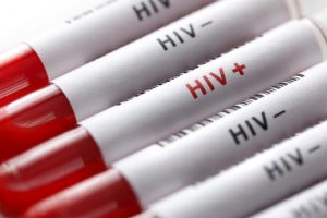 آزمایش ایدز | این افراد حتما باید آزمایش اید HIV (تست اچ آی وی) بدهند آزمایش ایدز | این افراد حتما باید آزمایش اید HIV (تست اچ آی وی) بدهند